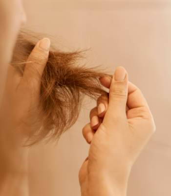 QUEDA DE CABELO PODE SER SINAL DE DEFICIÊNCIA DE FERRO? MÉDICO EXPLICA