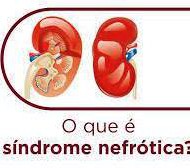 SÍNDROME NEFRÓTICA}