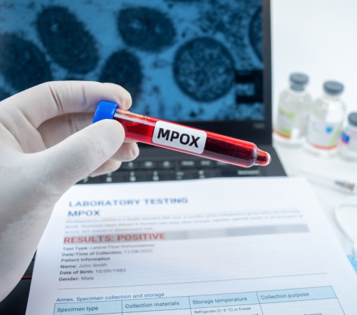ODONTOLOGIA TEM PAPEL ESTRATÉGICO NA IDENTIFICAÇÃO PRECOCE DA MPOX}