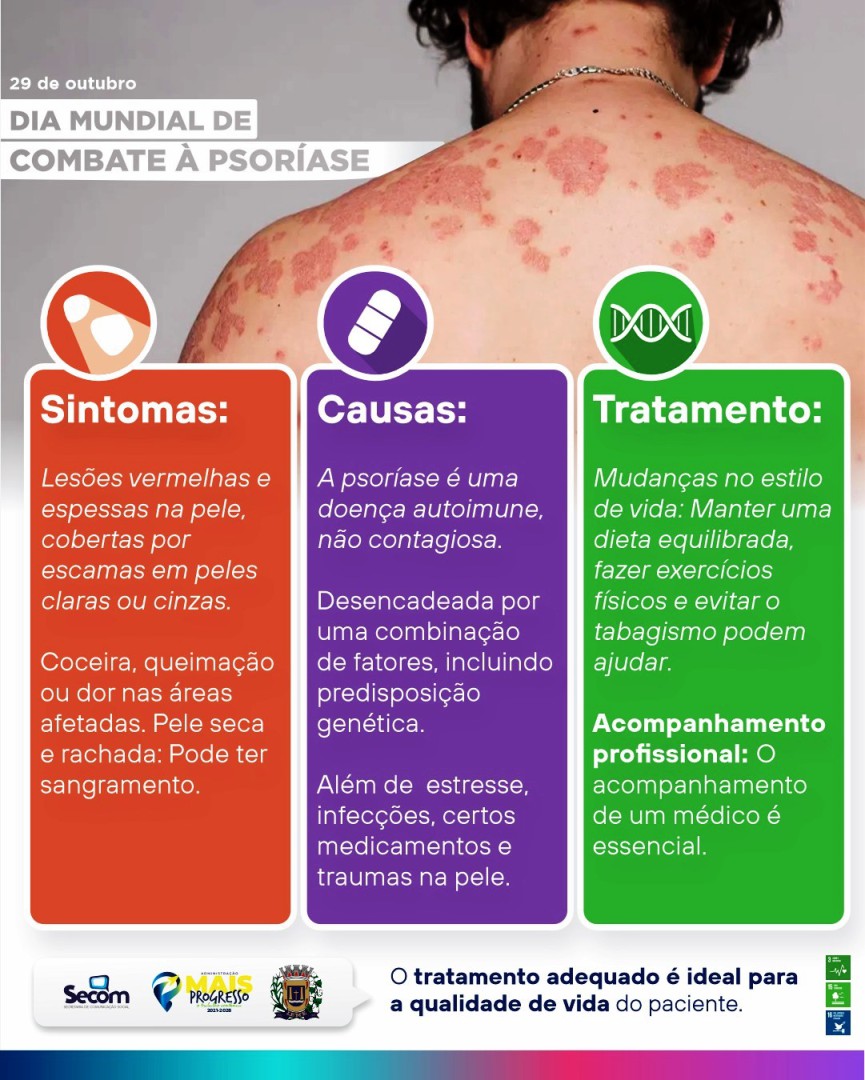 DIA NACIONAL E MUNDIAL DA PSORÍASE – 29 DE OUTUBRO