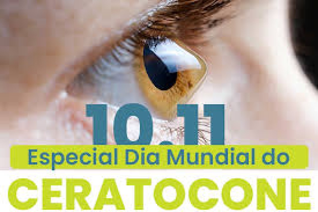 DIA MUNDIAL DO CERATOCONE: CONSCIENTIZAÇÃO E CUIDADO COM A VISÃO