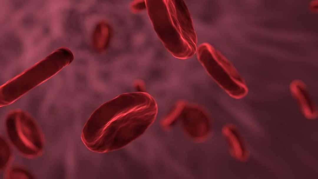 ANEMIA APLÁSTICA