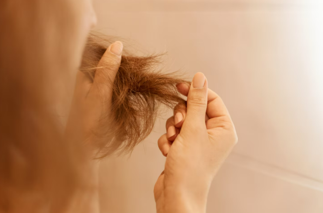 QUEDA DE CABELO PODE SER SINAL DE DEFICIÊNCIA DE FERRO? MÉDICO EXPLICA