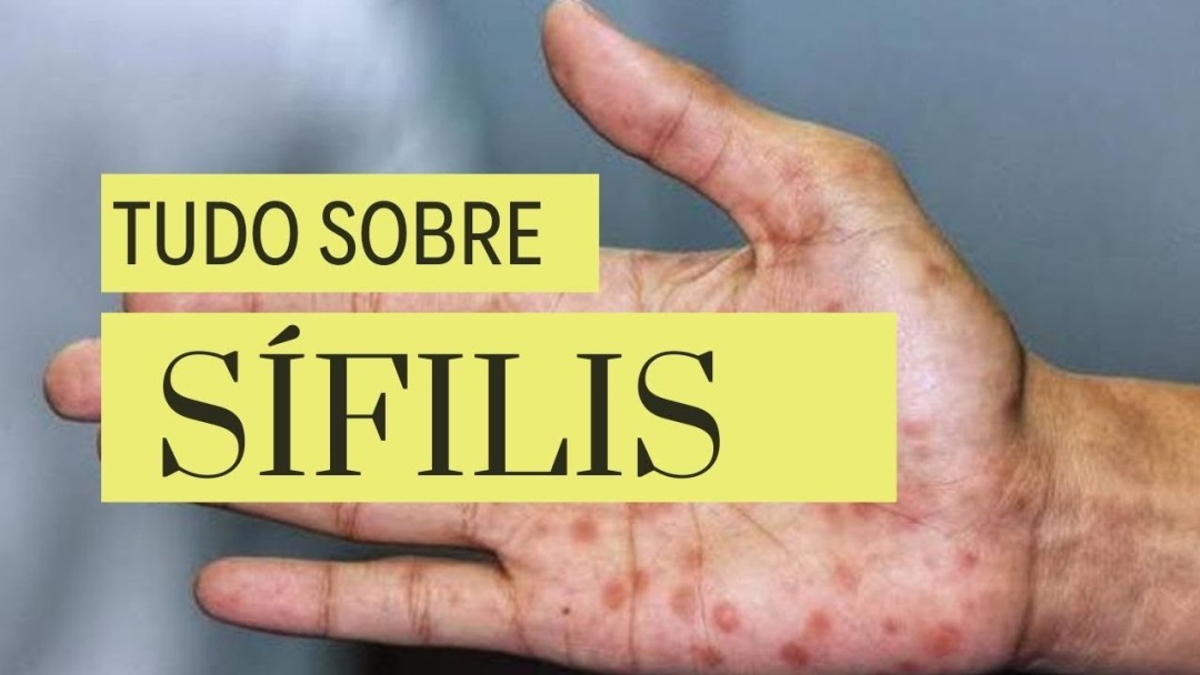 SÍFILIS, O QUE É?
