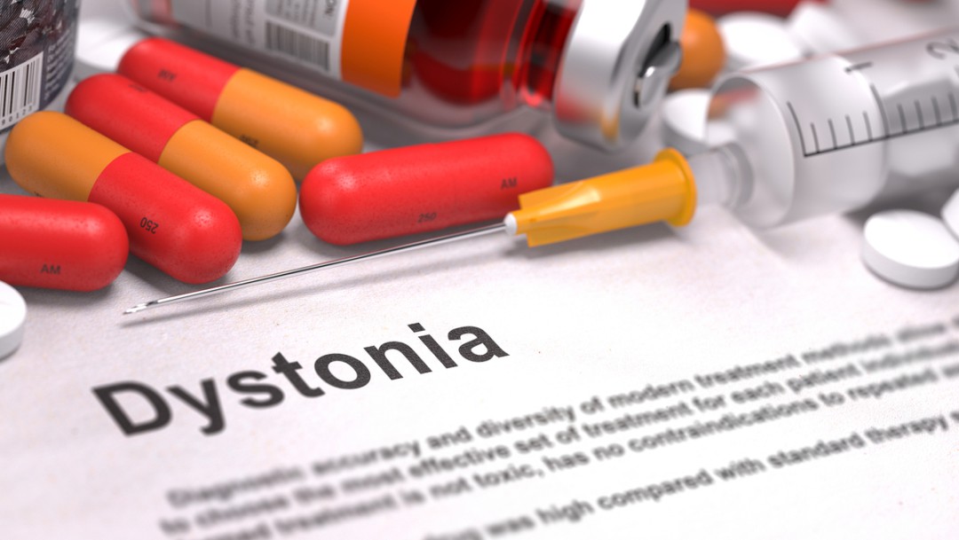 DISTONIA CAUSA ESPASMOS, MAS É DIFERENTE DO TIQUE NERVOSO
