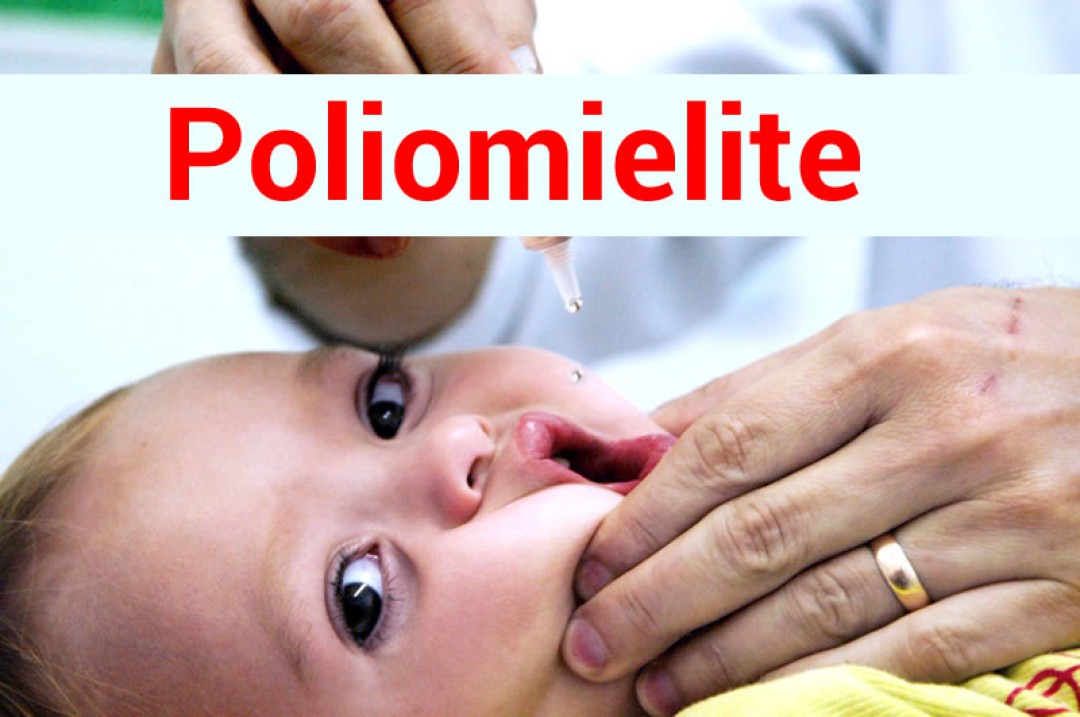 POLIOMIELITE